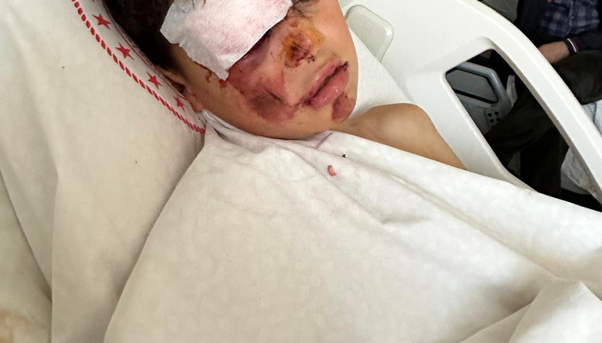 Otomobiliyle 12 yaşındaki bisikletliye çarpıp kaçtı, o anlar kamerada Otomobiliyle 12 yaşındaki bisikletliye çarpıp kaçtı, o anlar kamerada