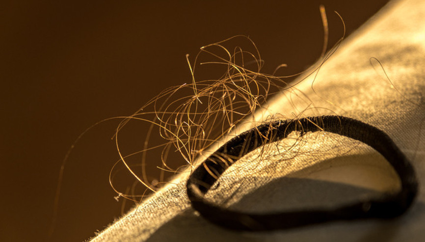 Saç dökülmesine ‘mevsimsel’ deyip geçmeyin Çoğumuz bunu yaşıyoruz ama sebebini bilmiyoruz... İşte türleri ve tedavi yöntemleri