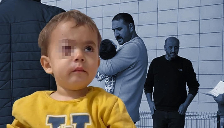 Baba, fırıncıyı daha önce uyarmış 2 yaşındaki Alpaslan gözünü kaybetti