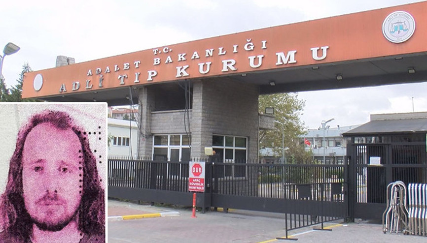 Türkiyeye saç ekimi ve diş tedavisi için gelmişti Operasyonun ardından hayatını kaybetti