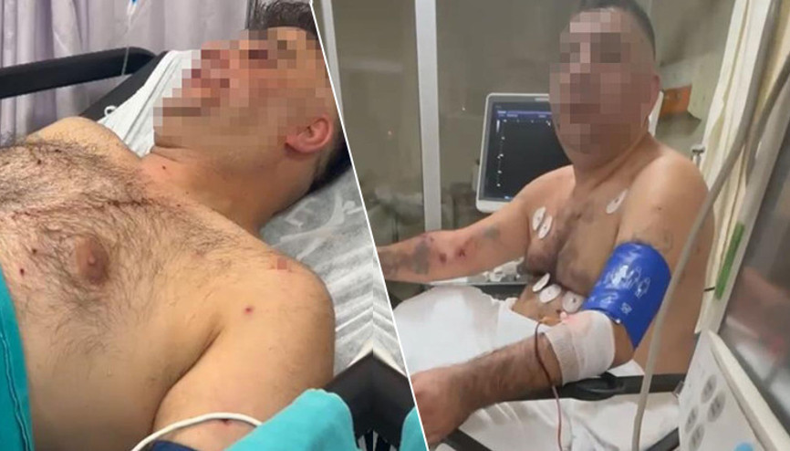 Pompalı tüfekli saldırgan terör estirdi: 1i polis 4 yaralı