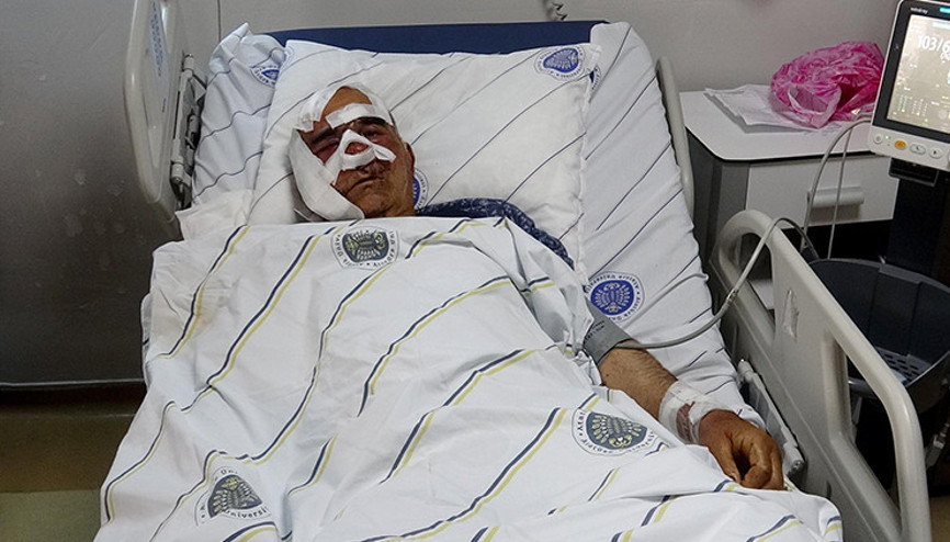 Köyde 5. kez aynı kabus Yaşlı adama saldırdı, pençe darbeleriyle yüzündeki kemiği kopardı