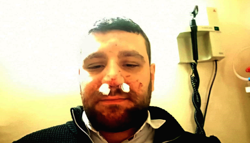 Trafikte yol verme tartışmasında avukatın burnu kırıldı Trafikte yol verme tartışmasında avukatın burnu kırıldı