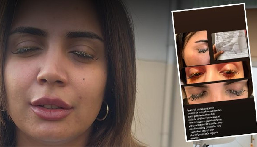 Güzellik merkezinde gözüne yapıştırıcı kaçan genç kadın az kalsın kör olacaktı