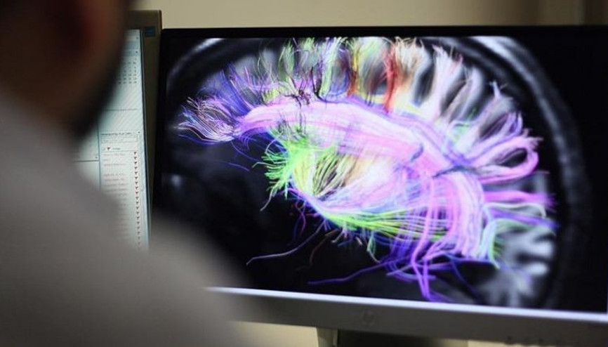 Cambridge Üniversitesinden çarpıcı araştırma: İnsan beyni 5 evreden geçiyor, ergenlik 32 yaşına kadar sürüyor