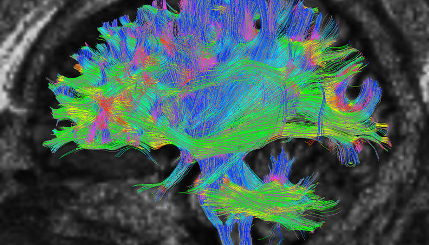 Bu araştırma yaşla ilgili bildiğimiz her şeyi yerle bir etti 32 yaşında ergenlikten çıkıyor, 66’da ise yaşlanmaya başlıyormuşuz