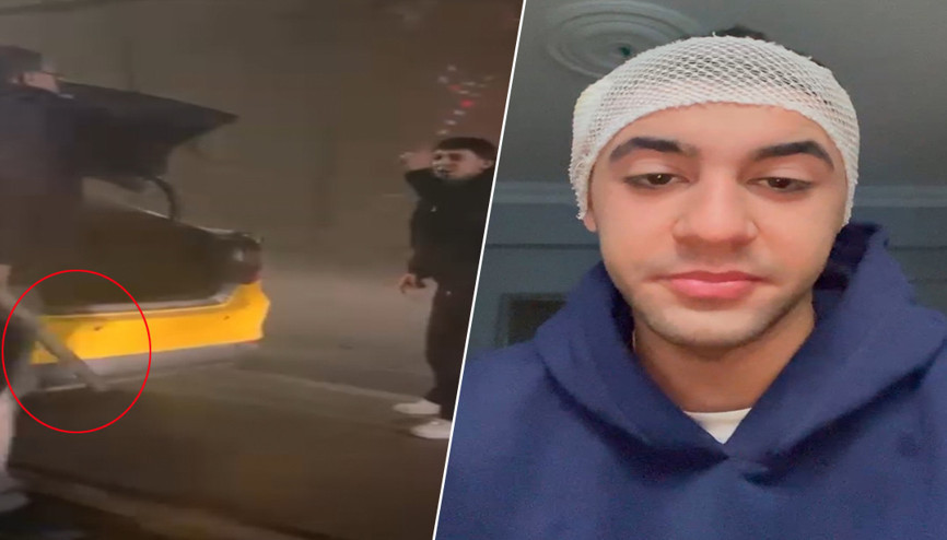 Tartışmaya girdiği taksicisi, motosiklet sürücüsünü sopayla yaraladı Tartışmaya girdiği taksicisi, motosiklet sürücüsünü sopayla yaraladı