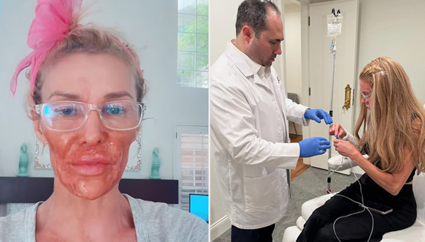 Ünlü yıldızın yüzü erimeye başlamıştı... Binlerce dolar harcadı, gerçeği buldu: Sonunda teşhis konuldu