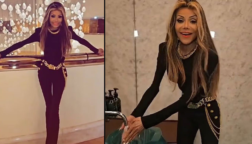 Ünlü şarkıcı koptu kopacak: Bakın işinize ben iyiyim