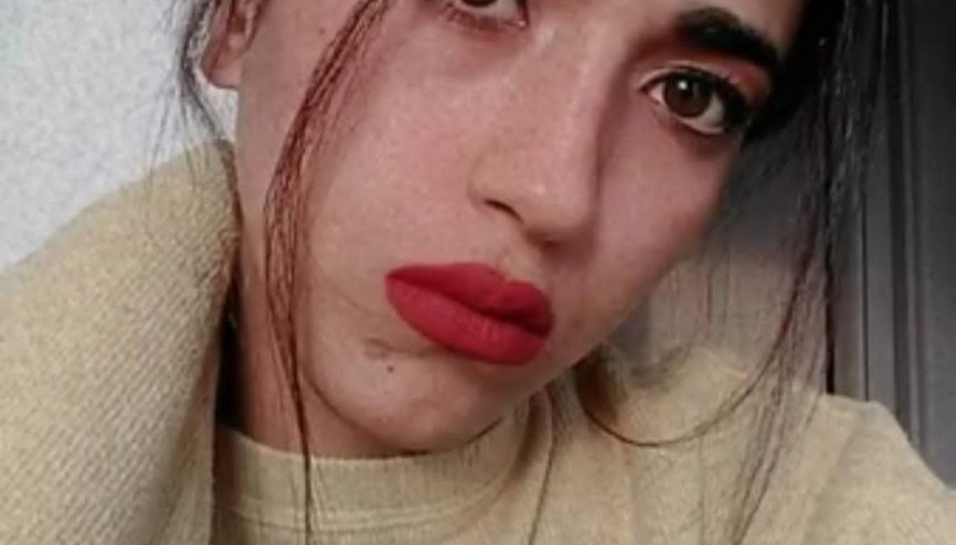 Kazada yaralanan motosiklet tutkunu Ayşe, yaşam mücadelesini kaybetti Kazada yaralanan motosiklet tutkunu Ayşe, yaşam mücadelesini kaybetti