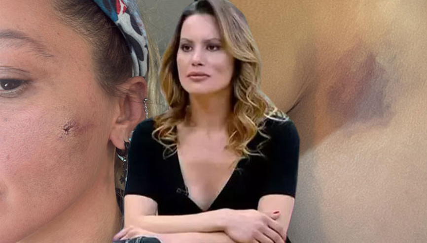 Ünlü oyuncu Yıldız Asyalıdan şoke eden iddia: Kocam tarafından darp edildim