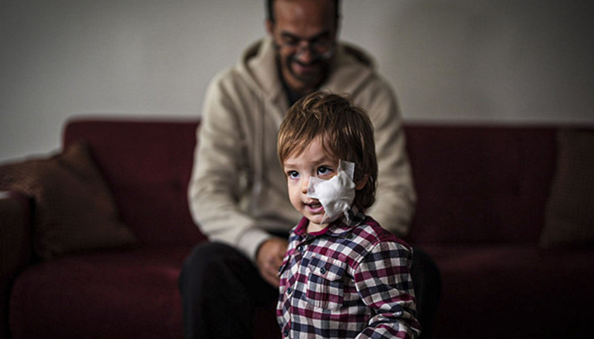 Ankarada iki kardeş pitbull saldırısına uğramıştı 1.5 yaşındaki Efe de taburcu oldu