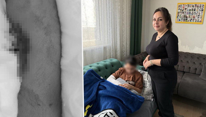 Okulda akran zorbalığı: 9 yaşındaki çocuk arkadaşının kolunu iki yerinden kırdı Öğretmene şikayet ettiği için intikamını aldım