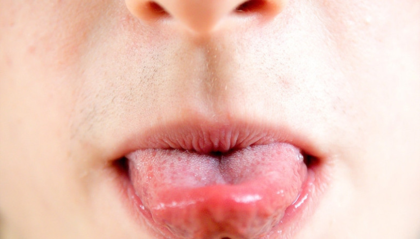 Bu 5 dil egzersizi horlamayı durdurabilir Bu 5 dil egzersizi horlamayı durdurabilir