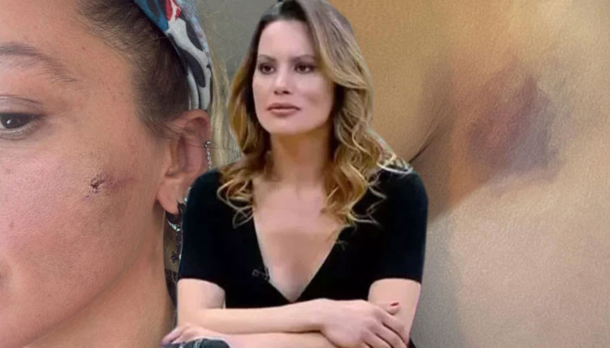 Yıldız Asyalı eşinden şiddet gördüğünü iddia etmişti... Korkuyorum