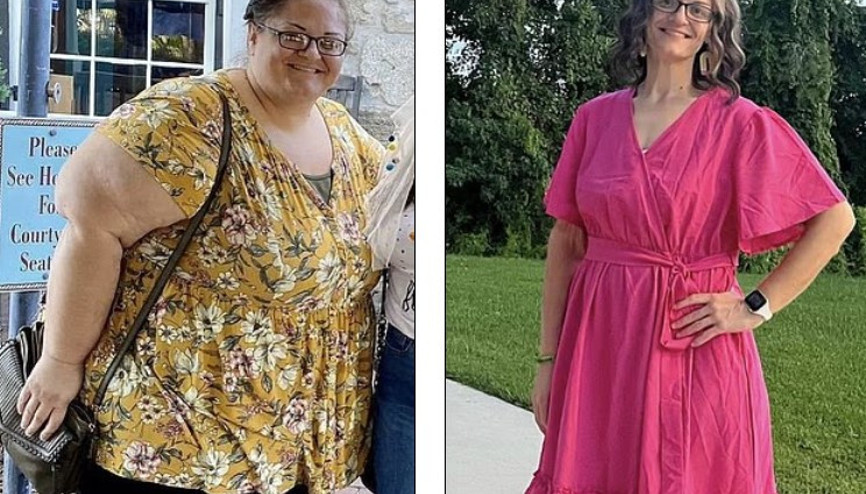 Ortaya çıkan sonuç inanılmaz: İğne ile kilo vermek mi, cerrahi müdahale mi Araştırma çarpıcı farkı ortaya koydu...