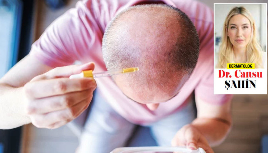 Kellik tarih mi oluyor