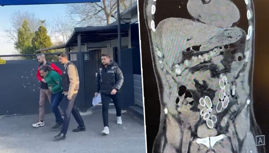 Fastan Türkiyeye midesinde getirdi Ameliyatla çıkarıldıktan sonra tutuklandı