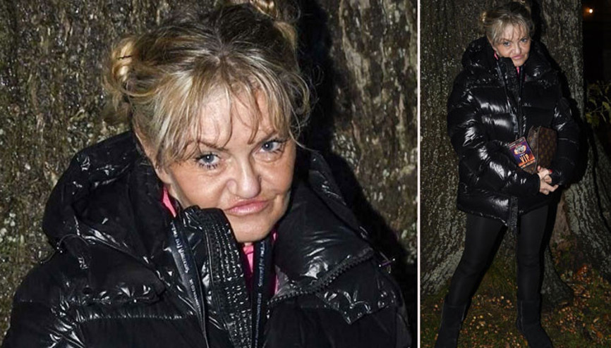 Erken gelen şöhret hayatını kararttı... Dağılan yüzünü toplamak için servet harcıyor: Aynaya bakamaz oldum