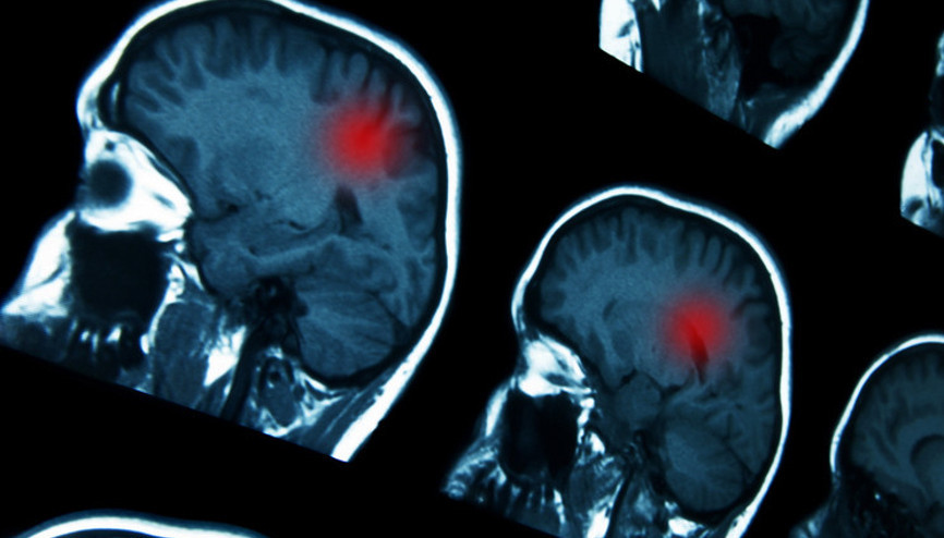 14 yaşındaki gence ‘normal’ denilen baş ağrılarının sebebi korkunç hastalık çıktı ‘Ona bir tarama bile yapılmadı