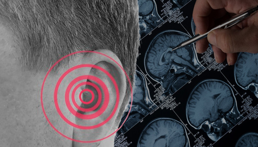 Yıllarca önemsemedi, gerçek çok sonra ortaya çıktı: ‘Hayatta olduğum için şanslıyım’ | Kulak çınlamanız varsa dikkat