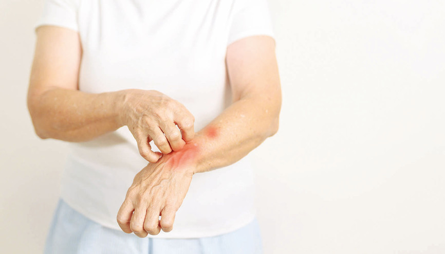 Türkiye’nin alerji haritası çıkarıldı