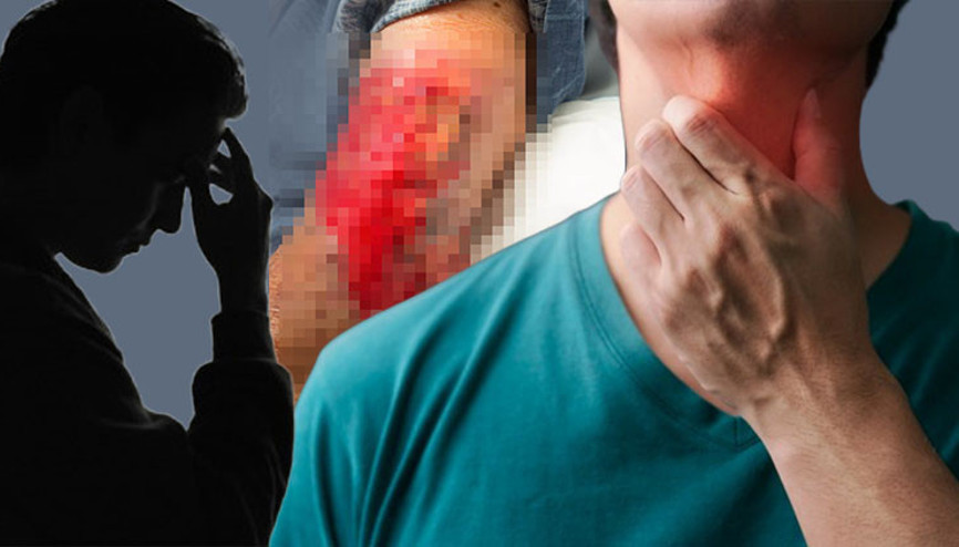 Basit bir boğaz ağrısı kâbusu başlattı: ‘Hayatta olmam bir mucize’ | 25 ameliyat geçirdi... Bu belirtilere dikkat