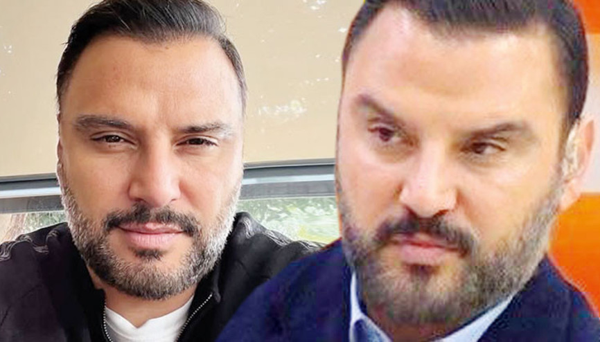 Alişandan botoks açıklaması: Kaşlar düştü sakin olalım