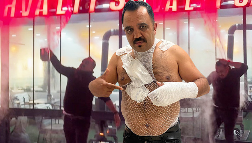 Yiğidoyu yakan soğuk testi Sivaslı esnaf hayatının şokunu yaşadı: Havaya attı, acı içinde kıvrandı