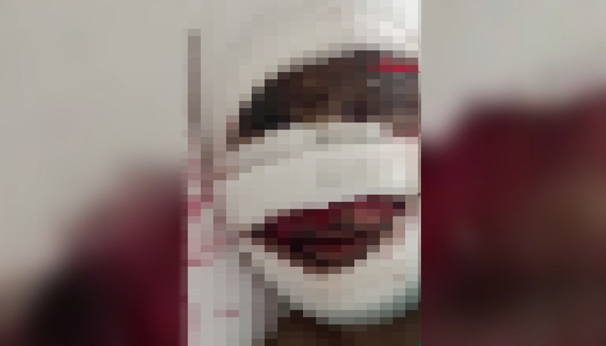 Eşinin başından aşağı kezzap döktüğü Sibel, olay anını anlattı