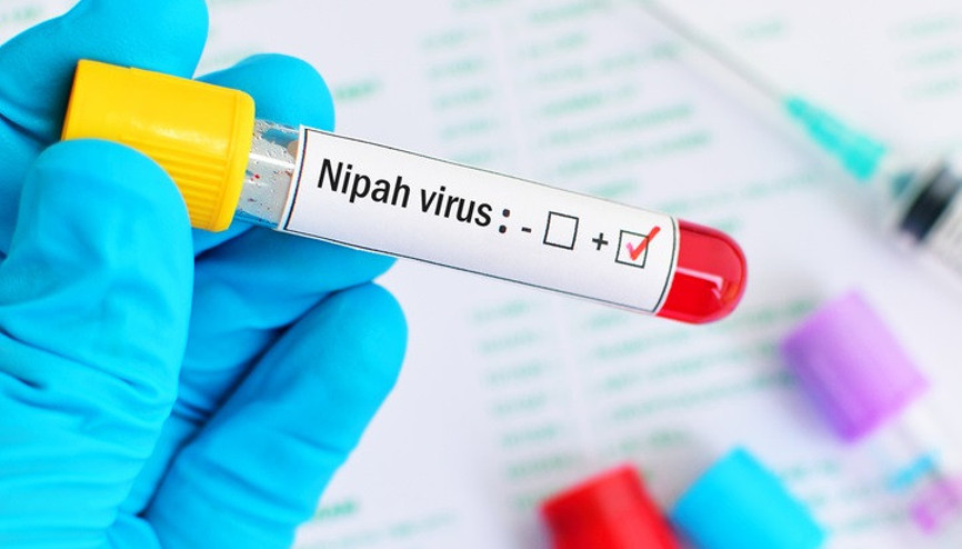 Nipah virüsü nedir, nasıl bulaşır, Türkiyede var mı Hindistan Nipah virüsü belirtileri ve korunma yöntemleri