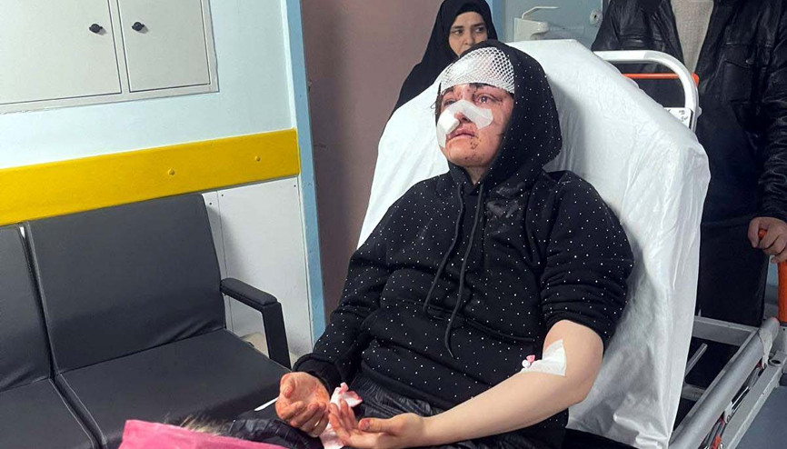 Boşanma aşamasındaki eşini kaldırım taşıyla dövdü