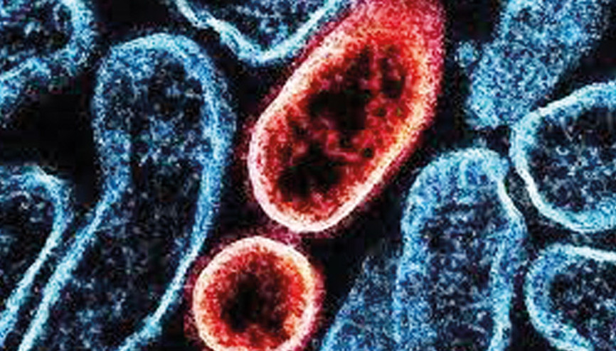 ‘Nipah pandemisi’ kapıda mı... 27 yıllık virüste salgın endişesi