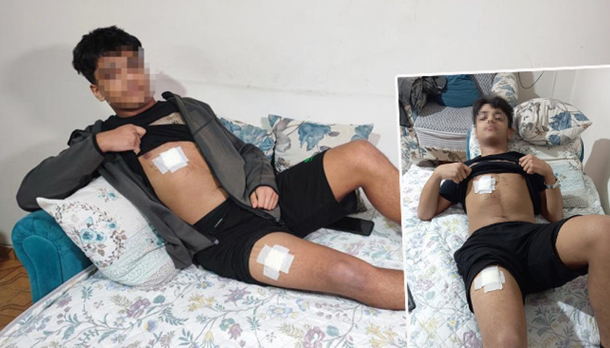 Mesajlaştığı kızın eski sevgilisi önce dövdü sonra bıçakladı 15 yaşındaki çocuklar dehşet saçtı: Bıçağı yedi, daha konuşamaz