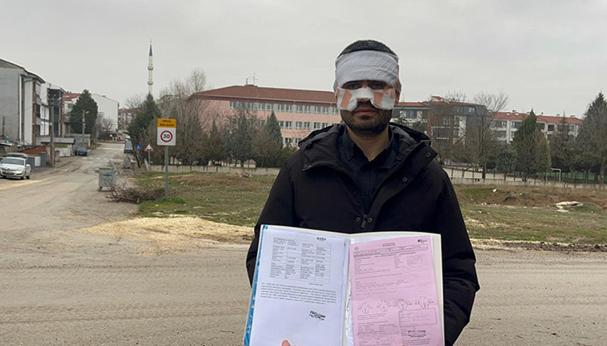 Fizik öğretmeni, rehber öğretmenin yüzüne sıcak çay fırlattı