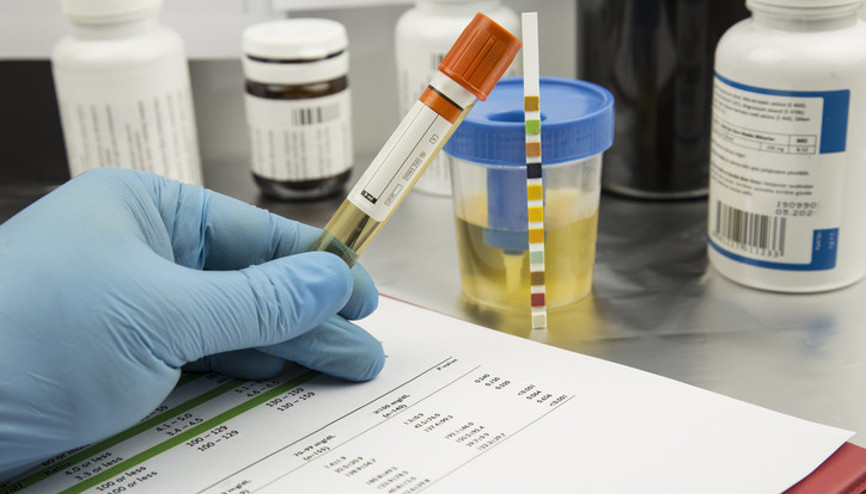 Erkeklerde idrar yolu enfeksiyonu