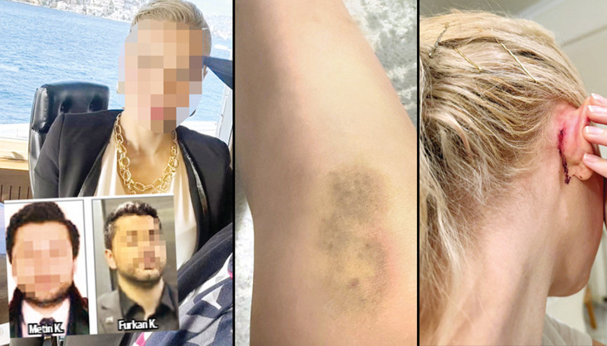 Ünlülerin avukatına saldırdılar