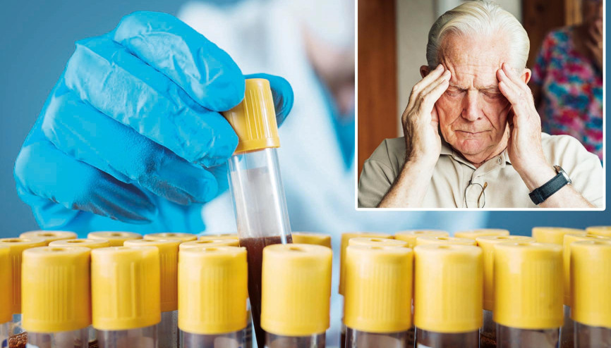 Kan testiyle Alzheimer’a erken teşhis