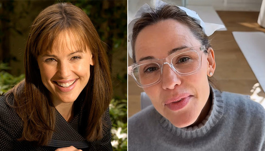 Estetik iddialarını sonunda cevapladı… Üç çocuğu ona yalvarmış: Anne ne olur yüzüne dokunma