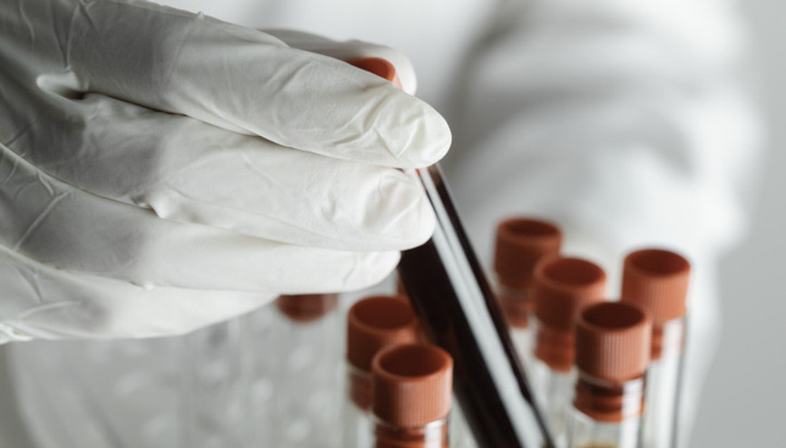 ‘Gençlik’ bu proteinlerde saklı olabilir... 100 yaşına ulaşmanın sırrı kanımızda mı