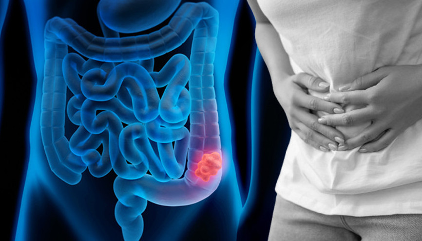 Bilim insanları yeni bir tedavi keşfetti Gençler arasında yayılmaya başlamıştı... O kanser tarih mi oluyor Bilim insanları yeni bir tedavi keşfetti Gençler arasında yayılmaya başlamıştı... O kanser tarih mi oluyor