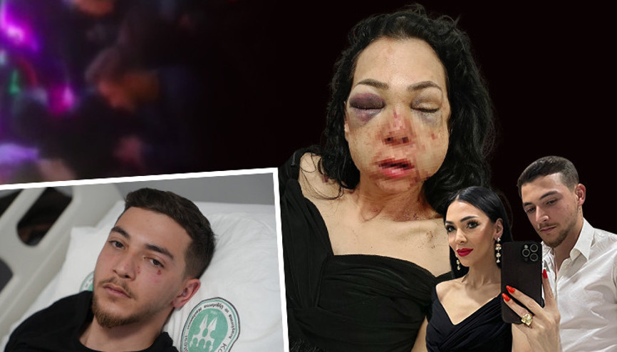 Bir uyarı yüzünden vahşet Anneye feci dayak... Oğlumun gözü önünde bana bunu yaptılar