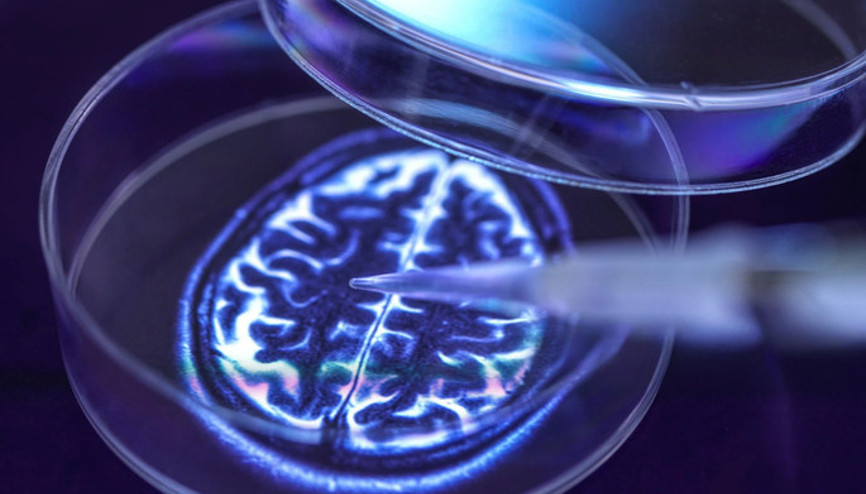 Alzheimer sonunda tarih mi oluyor Hafıza sorunları başlamadan önce sinyal verebilen test geliştirildi