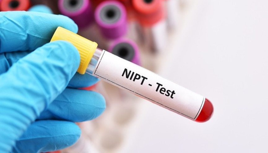 NIPT testi yaygınlaşıyor