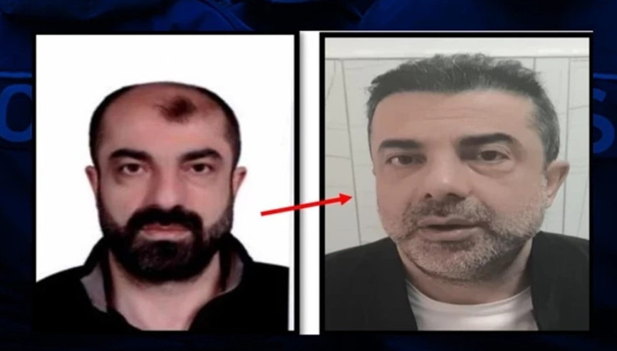 Cinayete azmettirmekten aranan şüpheli, ameliyatla yüzünü değiştirmiş Cinayete azmettirmekten aranan şüpheli, ameliyatla yüzünü değiştirmiş
