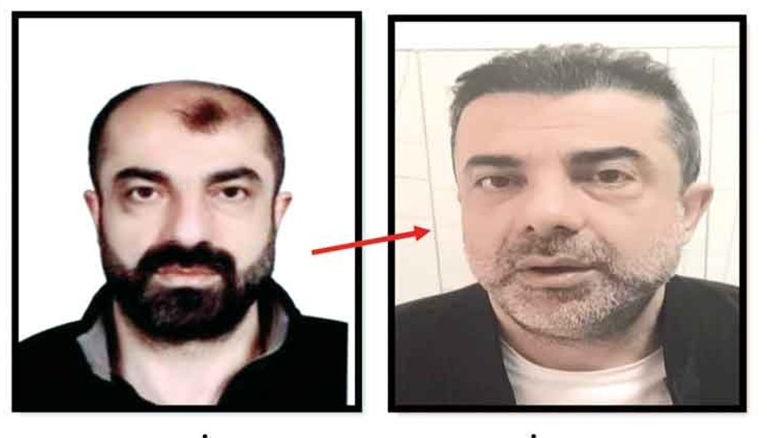 Azmettirici ameliyatla yüzünü değiştirmiş Azmettirici ameliyatla yüzünü değiştirmiş