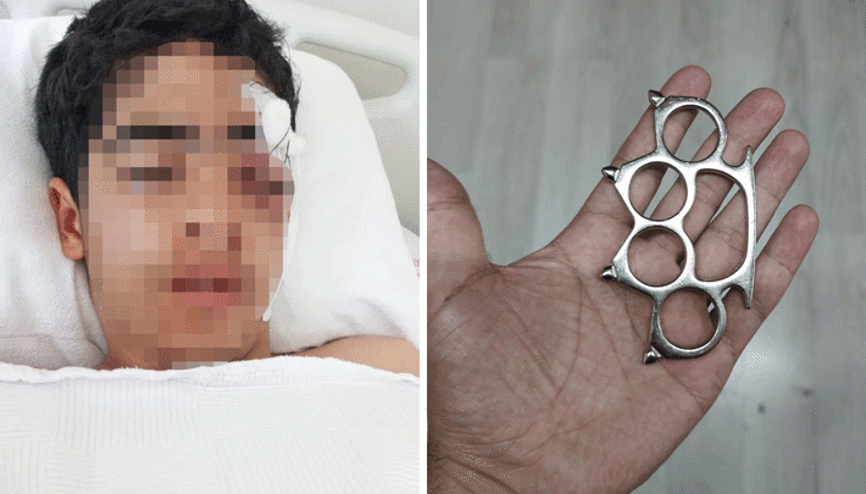 Esenyurtta dehşet 15 yaşındaki çocuk Bana şaka yapma dediği arkadaşı tarafından muştayla öldüresiye dövüldü