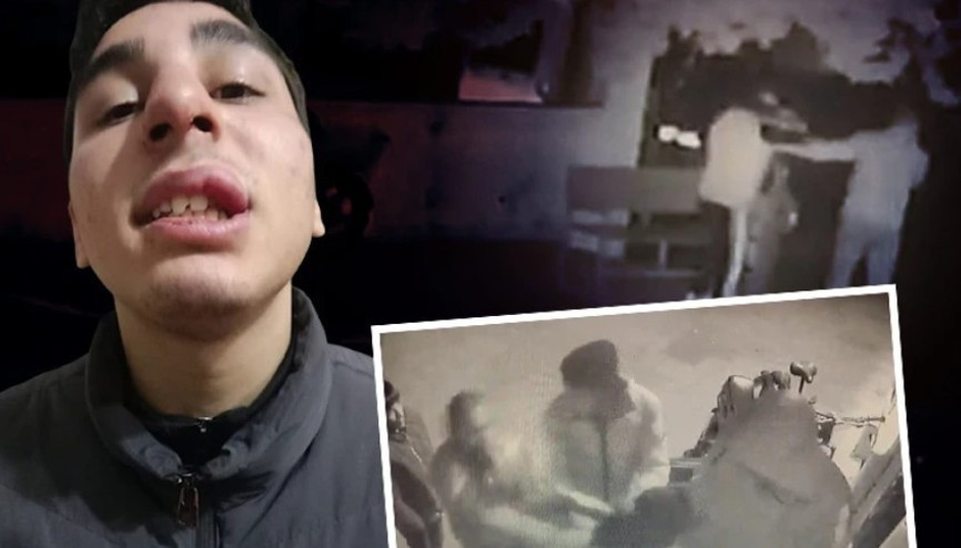 16 yaşındaki çocuk gündüz tartıştığı arkadaşının babası tarafından akşam darp edildi