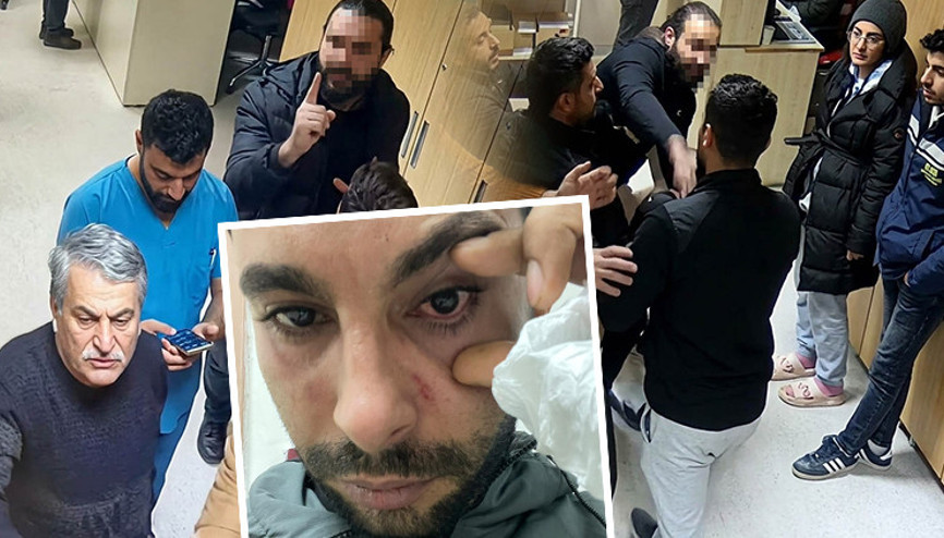 Doktordan hastaya yumruklu saldırı iddiası: Yüzde 30 görme kaybı oluştu | Düşmanına vurur gibi yumruk atıyor