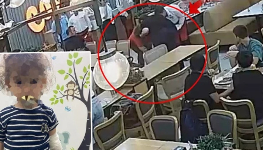 Restorandaki tereyağı şovu 2 yaşındaki bebeği yaktı
